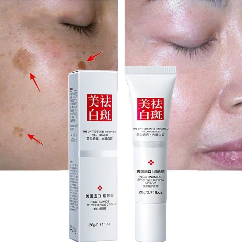 20 Gramas de Creme Clareador com Niacinamida e Vitamina E, Elimina Manchas Faciais, Alivia a Fadiga, Cuidados com a Pele
