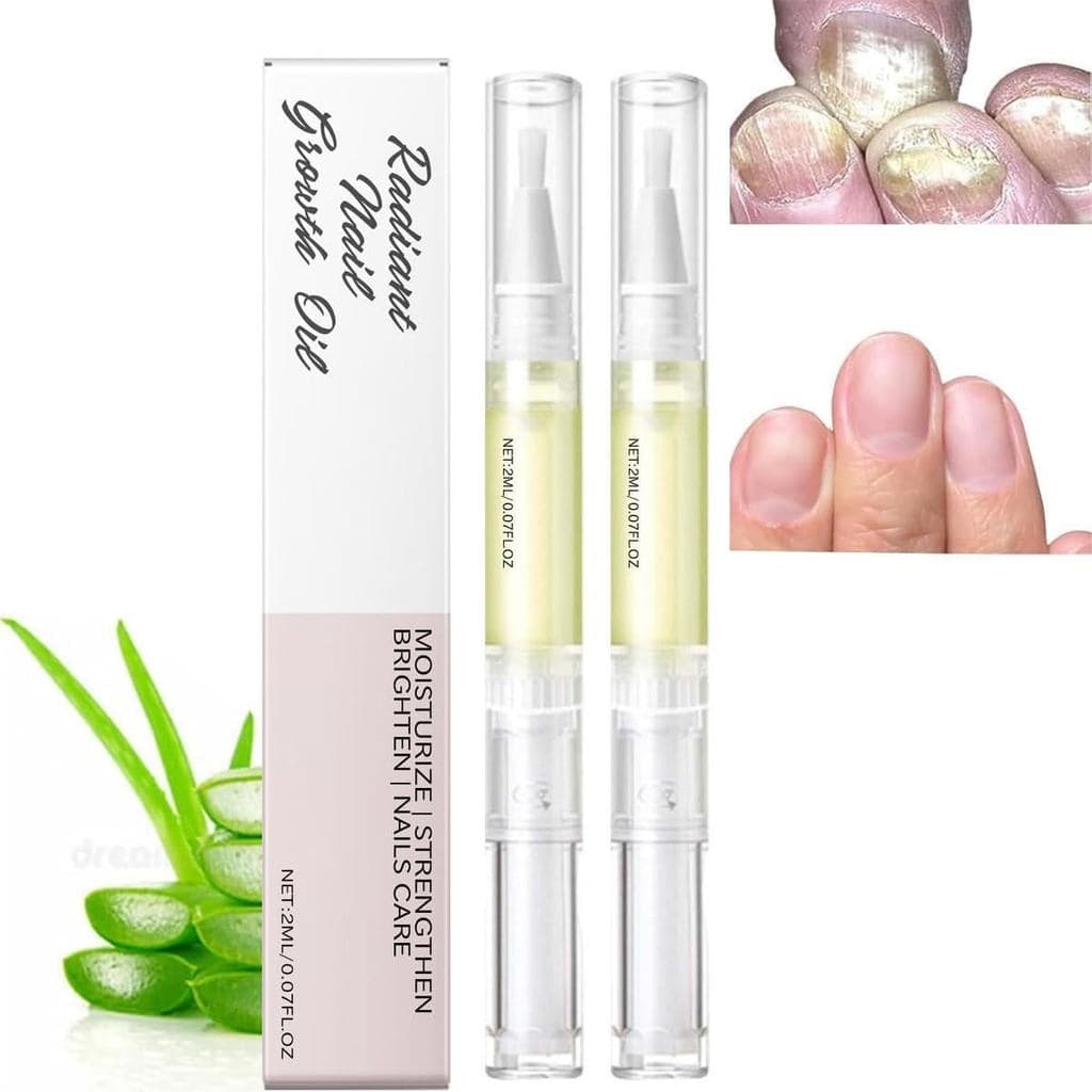 Caneta para Unhas Nailz, Caneta para Unhas Anperio, Óleo para Cutículas para Crescimento e Fortalecimento das Unhas (6 p