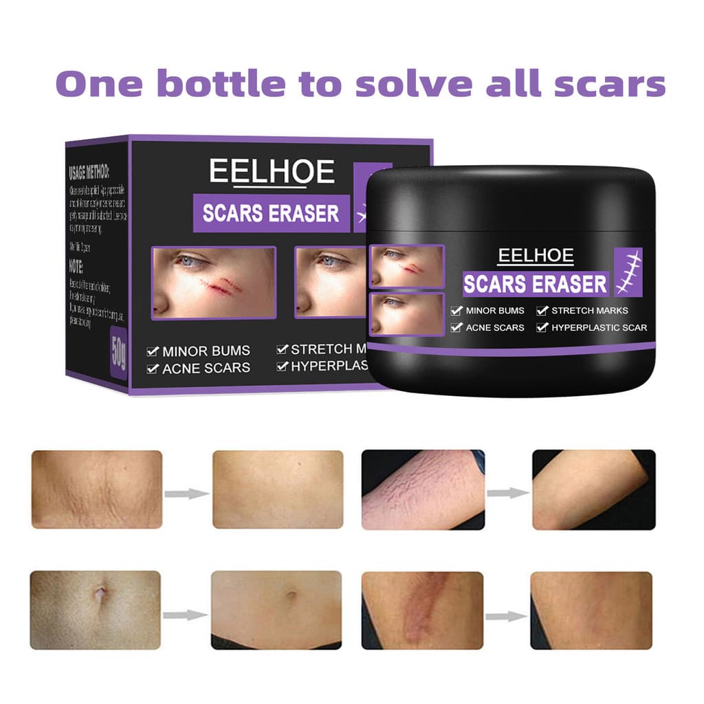 EELHOE Skin Repair Care Cream É Adequado Para Reduzir Vários Tipos De Cicatrizes