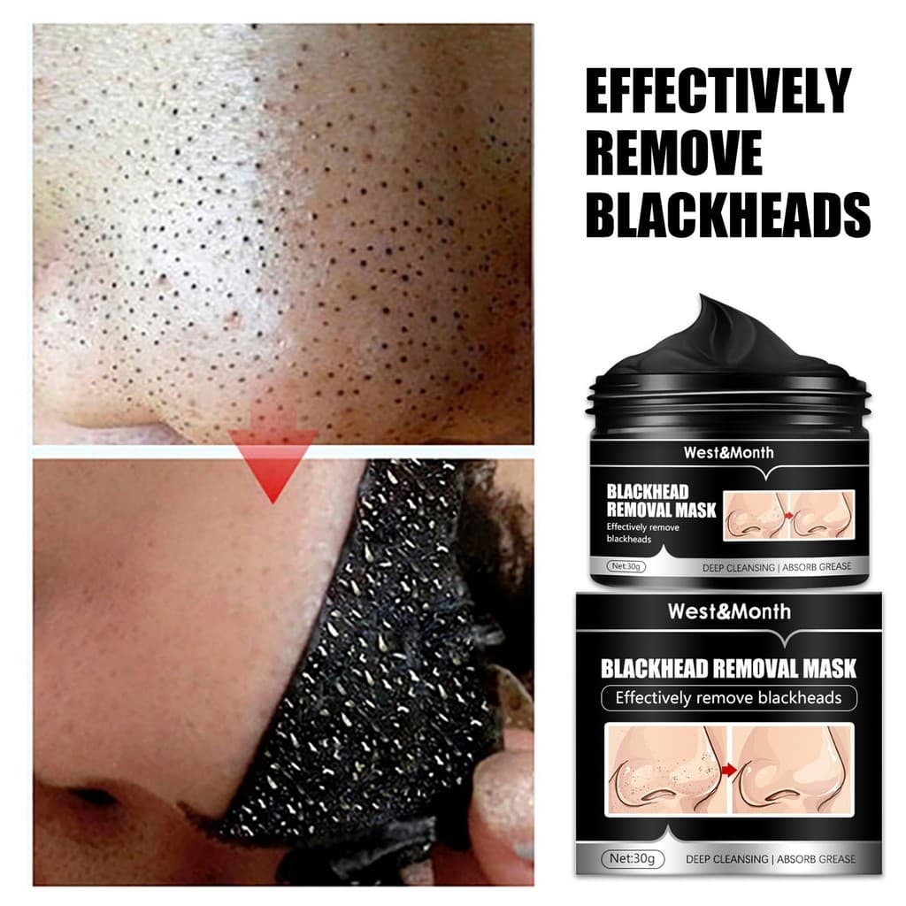 【Remoção de Cravos】Máscara Facial Removedora de Cravos Limpeza de Poros Máscara/Facial/Limpeza/Cravos