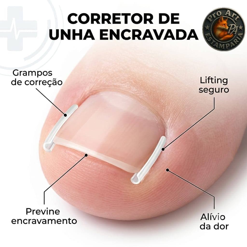 Fita Ortese Desencrar Unha Encravada Corretor com 10 Tiras