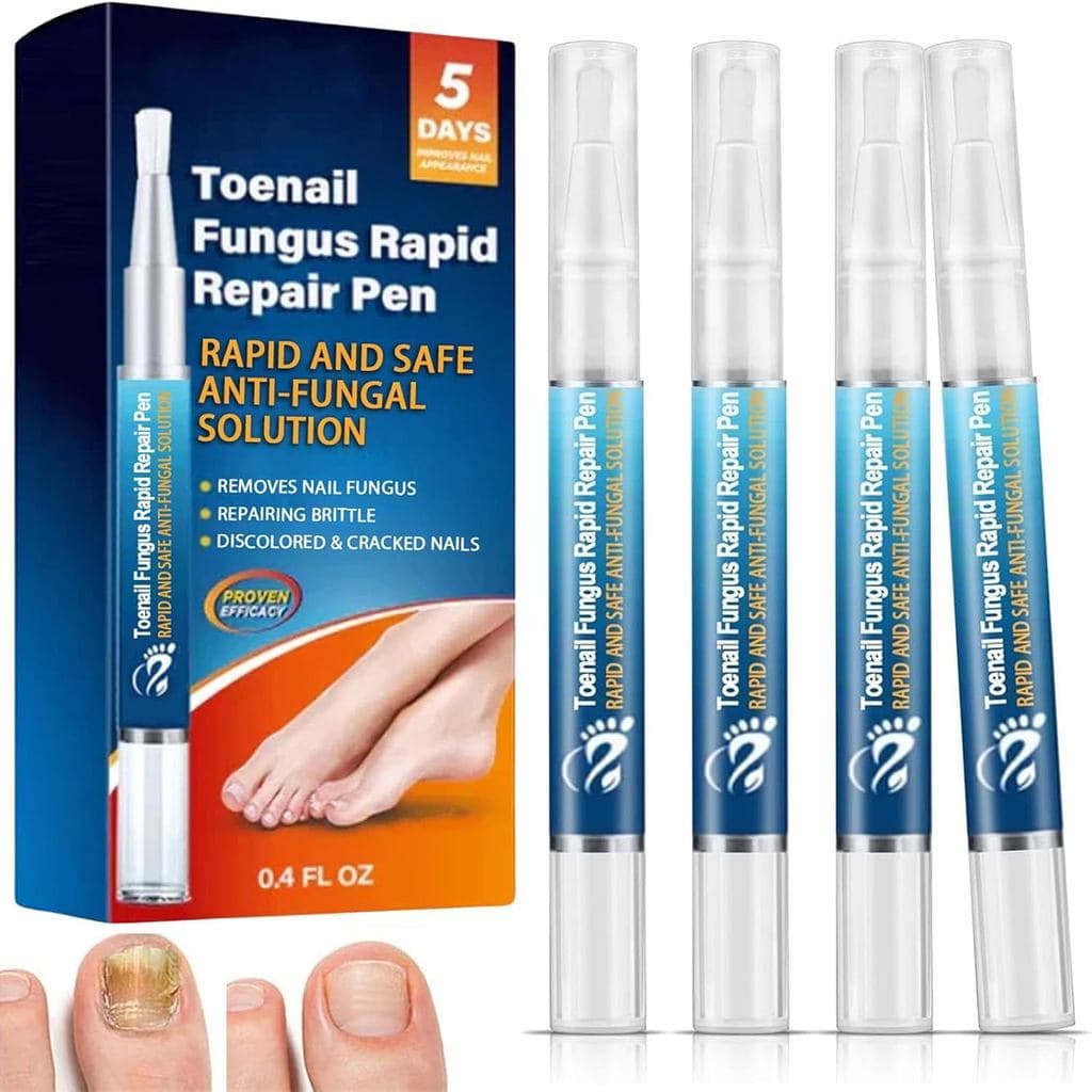 Canetas para cuidado das unhas dos pés e das mãos, kit com 4 canetas de óleo para unhas, sérum para unhas dos pés, sérum