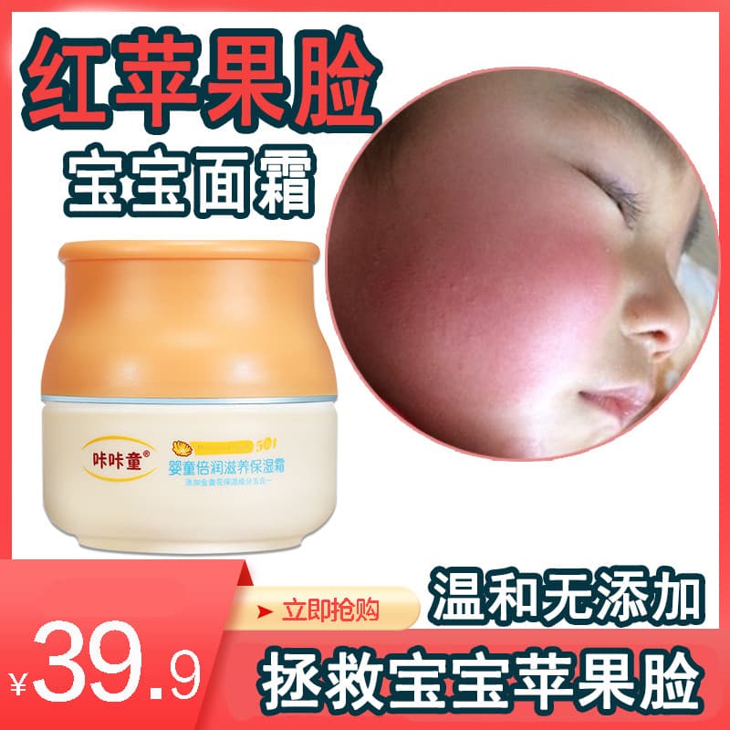 Apple rosto creme de bebê anticongelante anti-rachaduras creme facial crianças bebê crianças anti-vermelho rosto toque r