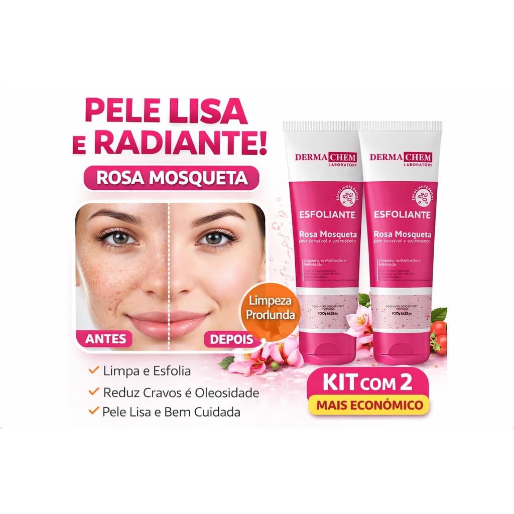 Gel Esfoliante Facial Rosa Mosqueta Dermachem 100ml Limpeza Profunda Pele Lisa Kit 2 Unidades