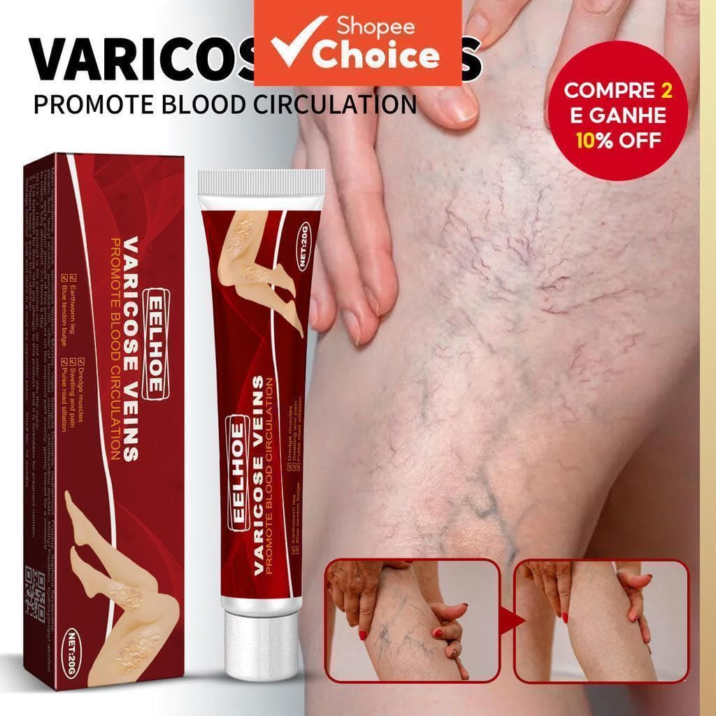 Creme Removedor de Varizes Eelhoe - Eficaz para Cuidados com as Veias das Pernas, Original Earthworm 【Escolha】