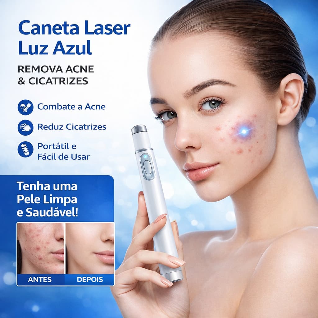 Caneta Laser Luz Azul Reduz Acne Terapia Cicatriz Portátil Tratamento Facial Redução De Marcas