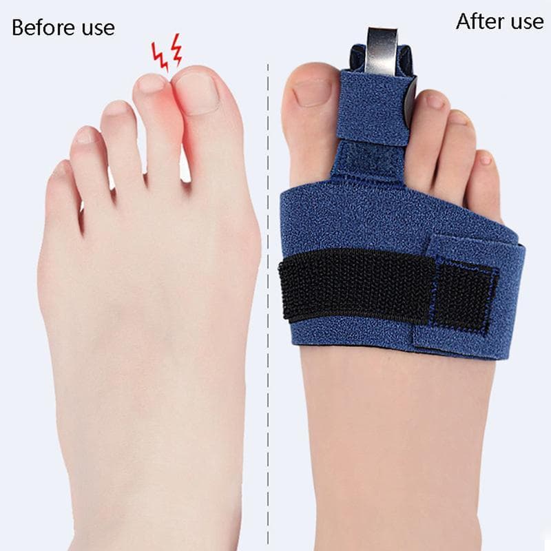 Finegoodwell5 1Pcs Corretor De Dedo Do Pé Hallux Bunion Alivia A Dor Joanete Valgus Alisadores De Talas BELLE