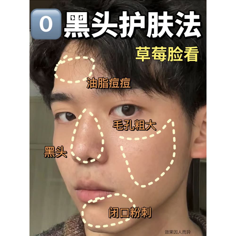 Limpador Facial masculino com controle de óleo, lista de classificação, primeiro lugar, remoção de cravos de alta qualid