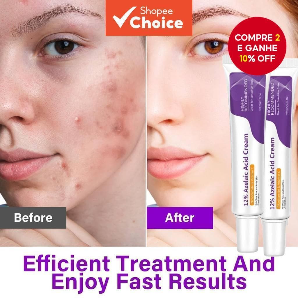 Soro De Ácido Azelaico Com Hialurônico Acalma Vermelhidão E Cuidados Faciais Sensíveis Para Reparo Da Pele