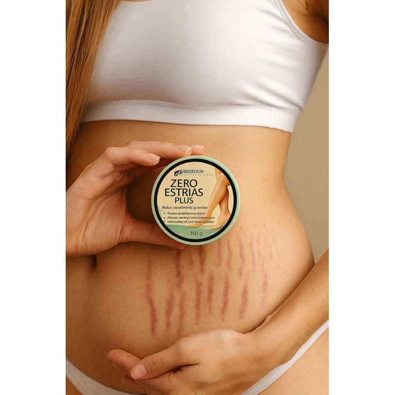 Redutor de Estruas Creme Zero Estrias Plus Anti Estrias Trata E Previne 150g - RedFour original PELE LISA E HIDRATADA