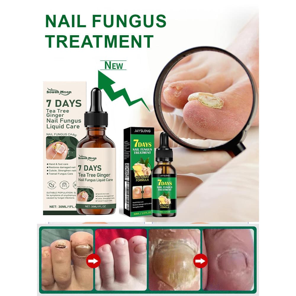 Ingredientes Naturais De Plantas Agente Para Cuidados Com As Unhas Fácil De Transportar A Aparência Das Diários