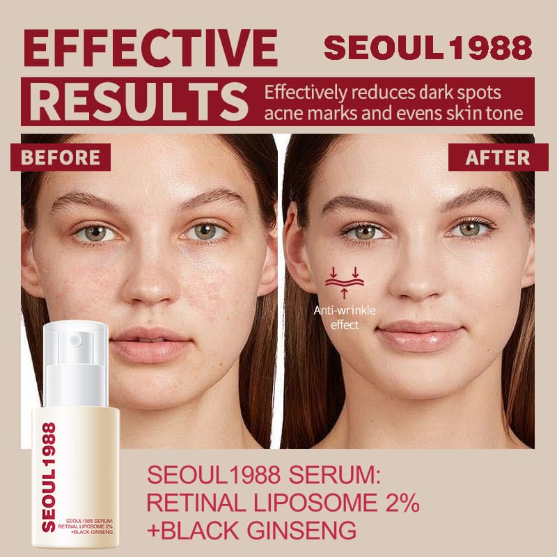 Produto quente Creme para os olhos com Retinol melhora a hidratação das bolsas dos olhos das olheiras