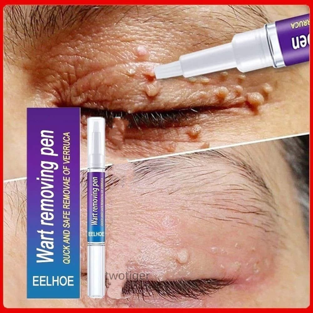 Exclusivo Creme Removedor De Manchas Escuras/Pigmentação