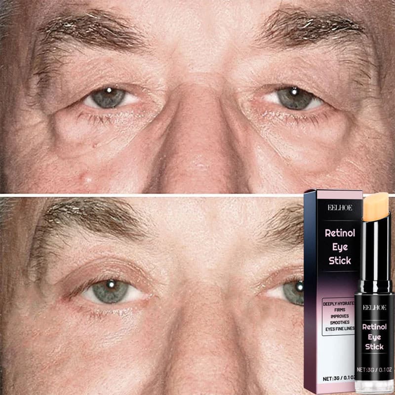 Creme Redutor Instantâneo De Saco Para Olhos , Colágeno , Antirrugas , Limpa Linhas Finas , Reafirmante Da Pele