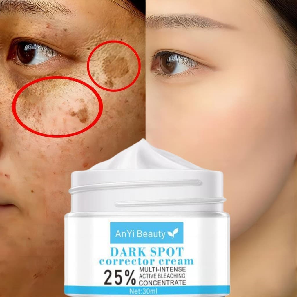 Clareamento Sardas Creme Remover Melasma Manchas Escuras Melanina Removedor Hidratar Anti-Envelhecimento Cuidados Faciai