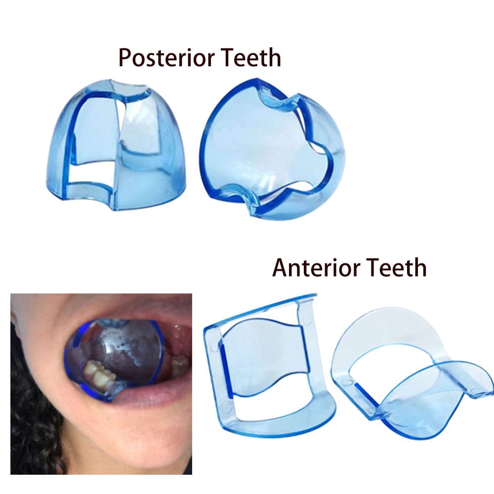 Abridor Retrator Ataroral 1/5pcs Para Ferramentas Expansoras Posteriores Anteriores