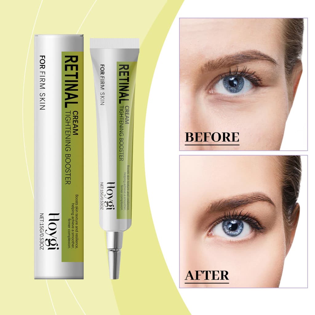 Creme Para Os Olhos Suave E Reafirmante Hidrata A Pele Dos Reduz Linhas Finas