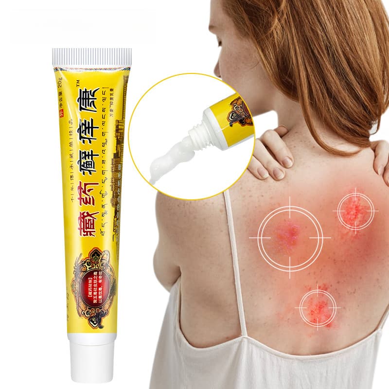 Creme Anti-Coceira para Eczema, Psoríase, Dermatite Antibacteriana