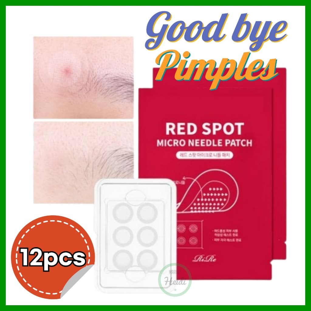 Coreia 🇰🇷 RIRE Red Spot Microneedle pimple patch/Remendo De Espinha Com Agulhas