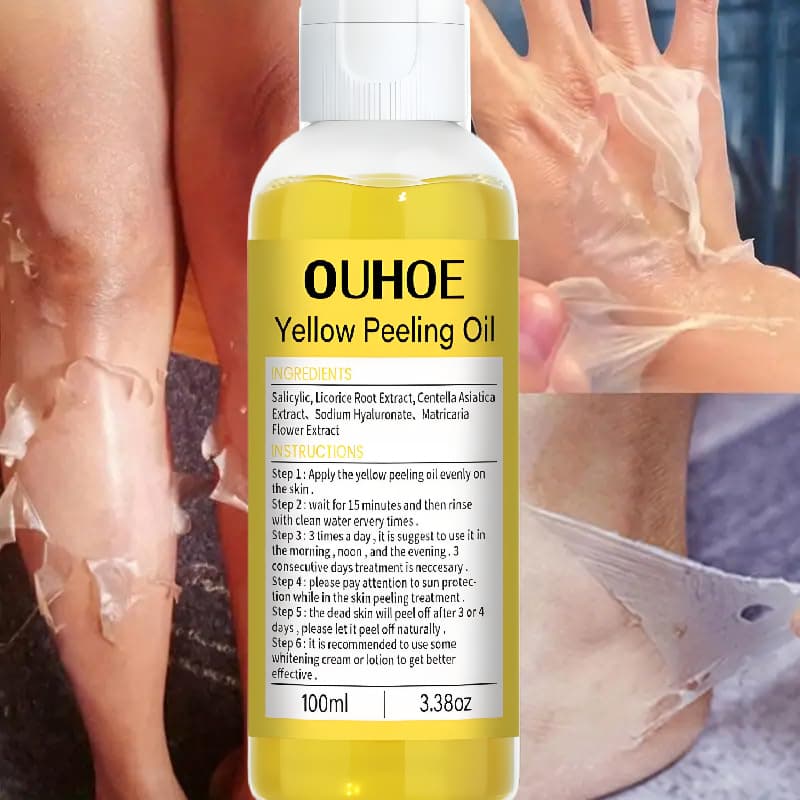 Novo Óleo Esfoliante Amarelo 100ml para Pele Escura, Óleo Esfoliante Forte Extra, Solução Esfoliante, Óleo Esfoliante