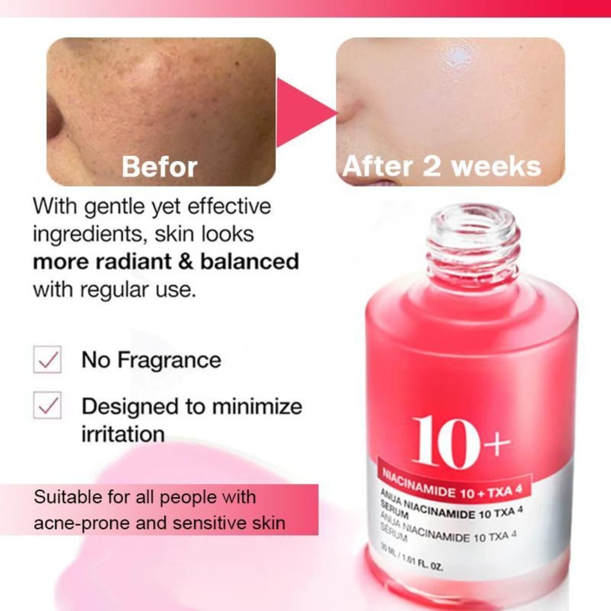 Soro Facial Hoygi Niacinamida 10 + TXA 3 | Iluminador De Pele Corretor De Manchas Escuras Cuidados Com A Que Aumentam O