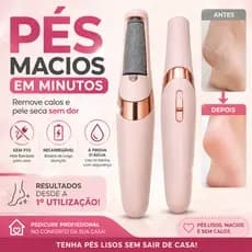 Lixa de Pé Elétrica Recarregável Removedor de Calos Pedicure Profissional À Prova D’Água USB