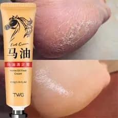 Creme Anti-Rachaduras Para Os Pés Reparação De Remoção De Óleo De Cavalo Calo Suave Cuidados Com As Mãos Mortas 30g