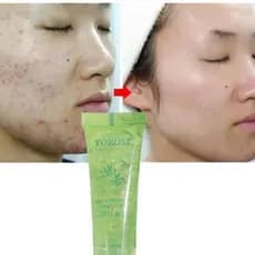 Creme 13G Aloe Vera 92% Concentrado Hidratante Para O Rosto