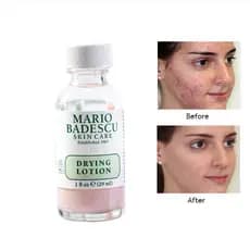 29ml Mario Badescu/mb Tratamento Eficaz De Acne Loção De Secagem Anti Espinha Remoção De Manchas Essência De Limpeza