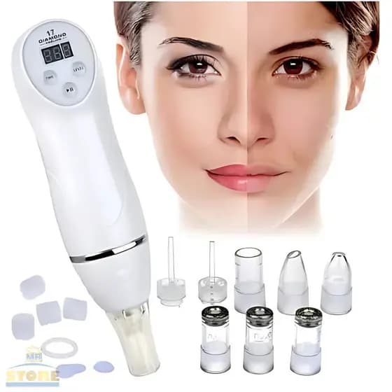 Removedor de Cravos e Espinhas Sugador Elétrico Peeling Diamante Limpeza de Pele