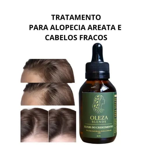 Blend Capilar Com Alecrim Crescimento Cabelos Com Queda Fracos e Ralos Combate a Calvice e Alopecia