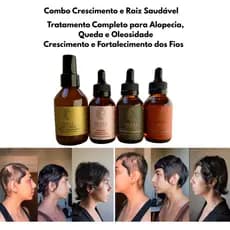Terapia Capilar Kit 3 Blends Oleza + Tônico Capilar – Tratamento Completo para Alopecia, Queda e Oleosidade
