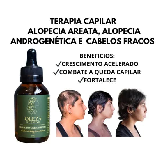 Tratamento Fortalecedor do Couro Cabeludo Para Acelerar o Crescimento Calvície e Alopecia