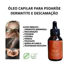 Blend de Óleos Capilar Alívio da Dermatite Seborreica Caspa Coceira Oleosidade Psoríase Feridas Dor no Couro Cabeludo
