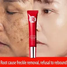 Creme forte original para remover manchas escuras/clareamento de pigmentos/cuidados com a pele QRJZ 2RWB