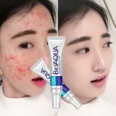 BIOAQUA 30g creme clareador/tratamento facial/poros #4 INR
