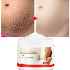 [MUSBAND] Creme reparador de cicatrizes, remoção de pele de estrias tratamento de gravidez grávida 30g TYSB