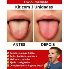 Kit - Limpador Raspador De Língua Em Aço Inox Para Higiene Bucal Promoção