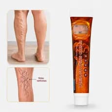 Creme Pomada Para Varizes Tratamento Veias Vasinhos Nas Pernas