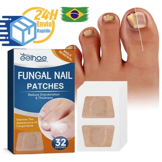 Adesivo Reparador de Unhas Cinza para Pés e Mãos – Tratamento de Fungos, Unhas Espessas e Paroníquia com Correção Eficaz