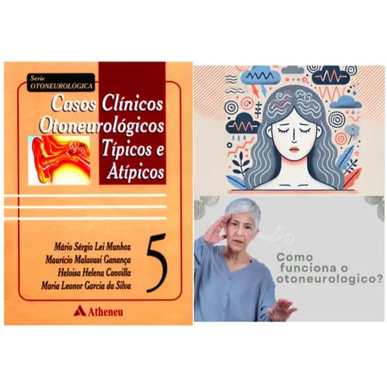livro Casos Clínicos Otoneurológicos Típicos e Atípicos (Volume 5) Otorrinolaringologistas e Fonoaudiólogos e outros