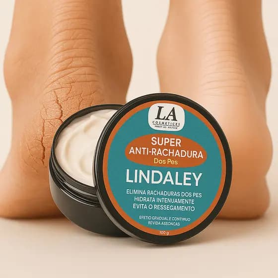 Creme Hidratante para Calcanhar Lindaley 100g – Hidratação Intensiva para Pés Secos e Ásperos