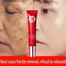 Creme Original Poderoso para Remoção de Manchas/Redução de Pigmentação/Produtos para Cuidados com a Pele QRJZ