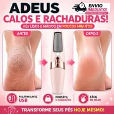 Lixa de Pé Elétrica Recarregável USB Removedor de Calos Pedicure Esfoliador À Prova D'Água