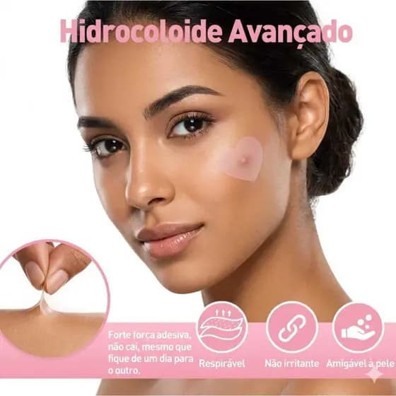 Adesivo Seca Espinhas Hidrocoloide Acne Coração Rosa 36/72/108