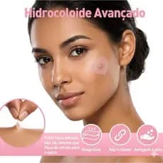 Adesivo Seca Espinhas Hidrocoloide Acne Coração Rosa 36/72/108