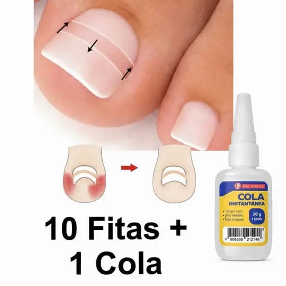 Fita Ortese Para Unha Encravada Desencravador Corretora 10 Pçs + Cola