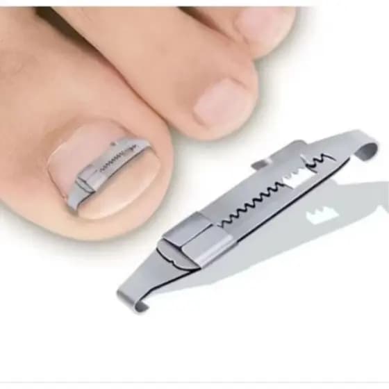 Ferramenta de Correção de Unhas Encravadas Unha Cuidado Higiene