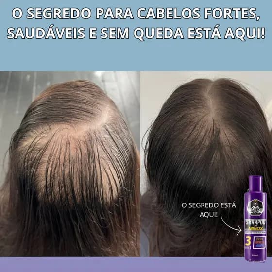 Shampoo Com Minox 3x Mais Ativos Nutritivo Antiqueda Para Crescimento Fortalecimento Capilar 250ml