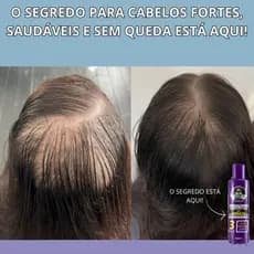 Shampoo Com Minox 3x Mais Ativos Nutritivo Antiqueda Para Crescimento Fortalecimento Capilar 250ml